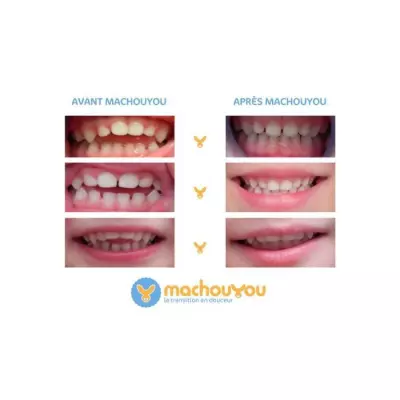 Anneau de dentition Machouyou pour les premières dents - Prune dès 2 ans