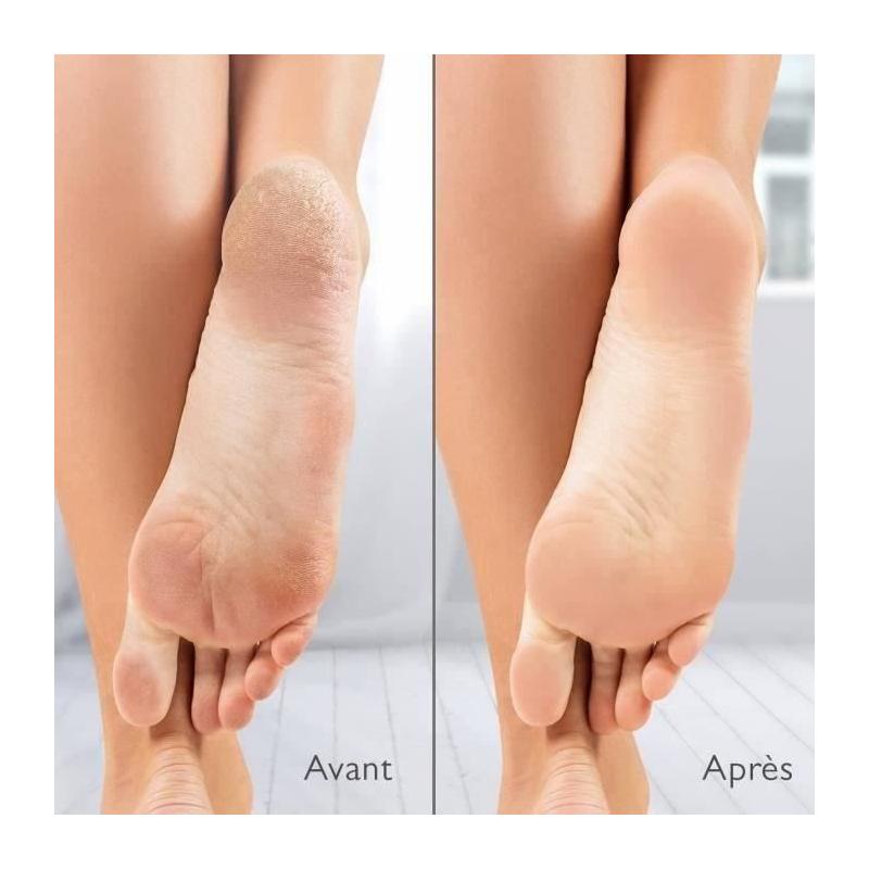 Râpe électrique anti-callosités avec aspiration - Silk'n Vacupedi